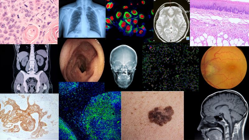 Your Model Might Be Misleading You: Bias and Batch Effects in Medical Imaging