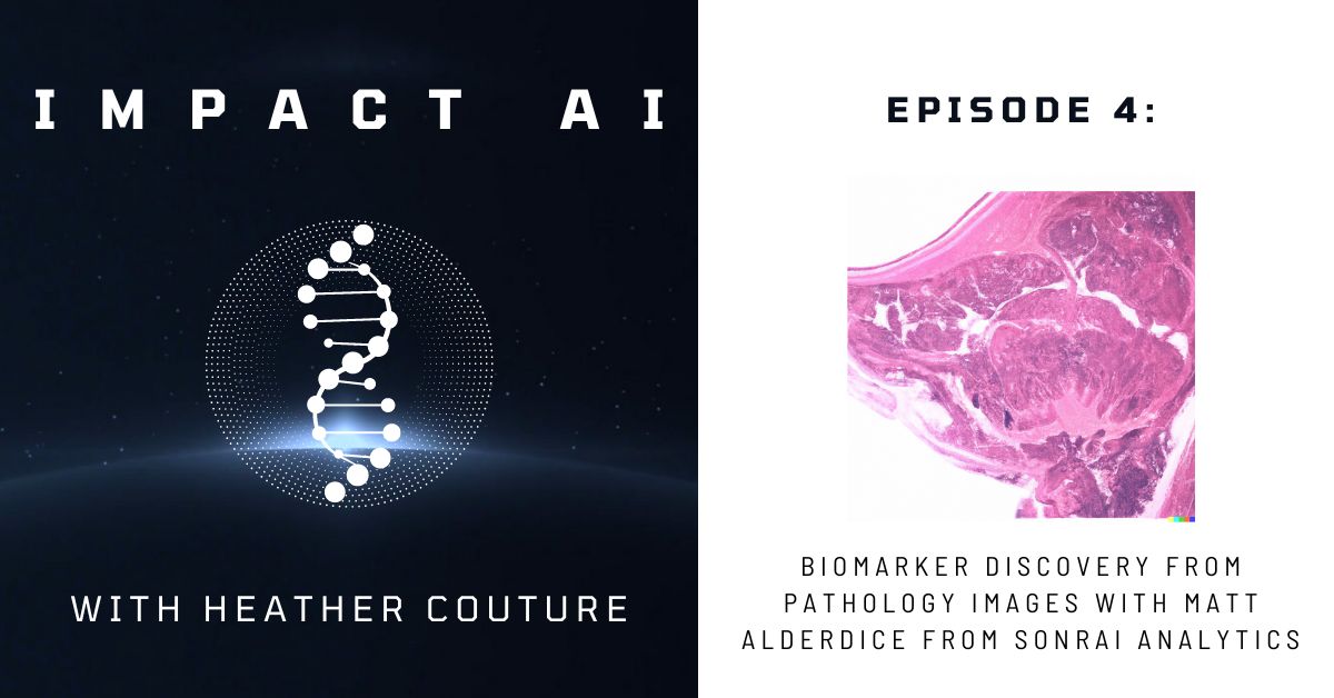 Biomarker Discovery from Pathology Images with Matt Alderdice from Sonrai Analytics