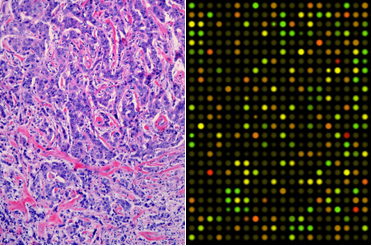 Integration of Image and Genomic Features of Breast Cancer